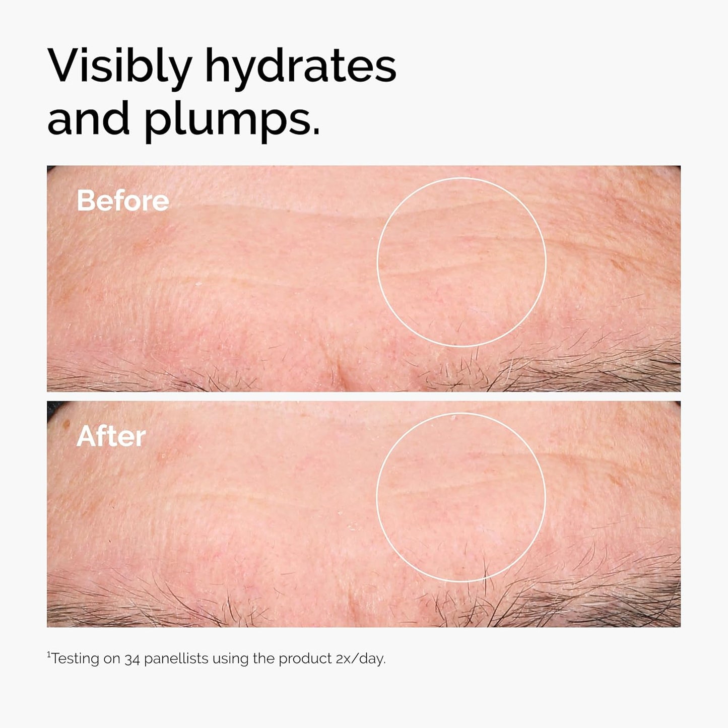 The Ordinary Hyaluronic Acid 2% + B5 (With Ceramides), Multi-Depth Hydration Serum for Plumper, Smoother Skin, 30Ml